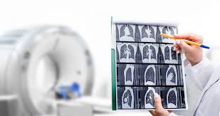 Medical Imaging and Diagnostics.jpg
