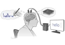 Brain-Computer Interfaces (BCI).jpg