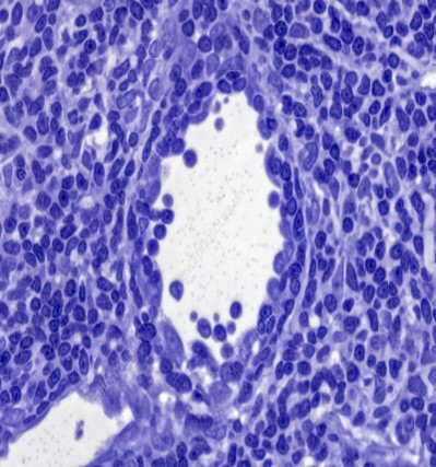HIGH ENDOTHELIAL VENULES 2.jpg