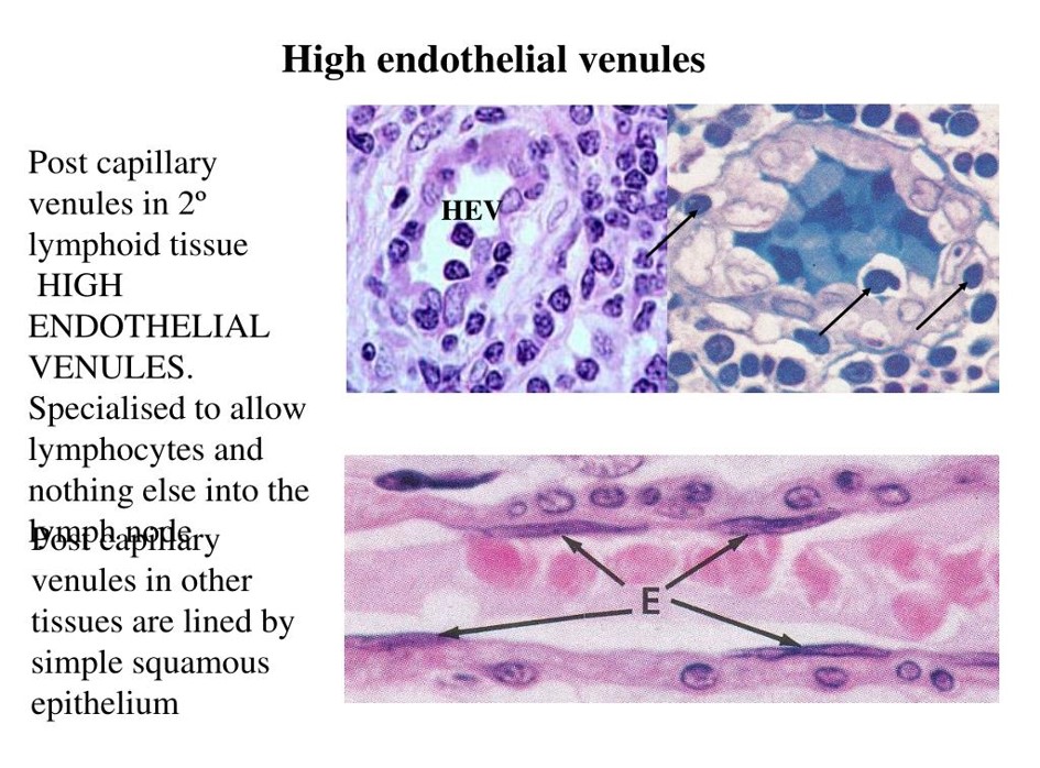 High endothelial venules.jpg