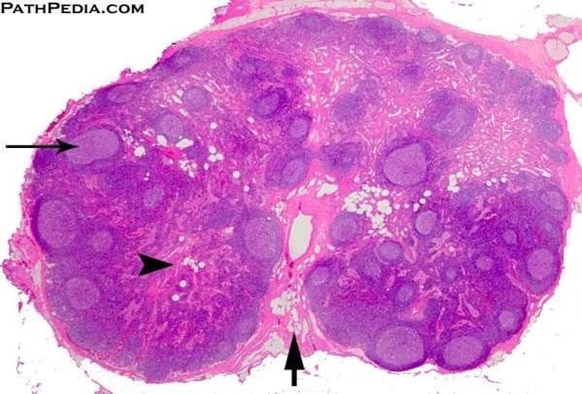 LYMPHNODE HISTOLOGY.jpg