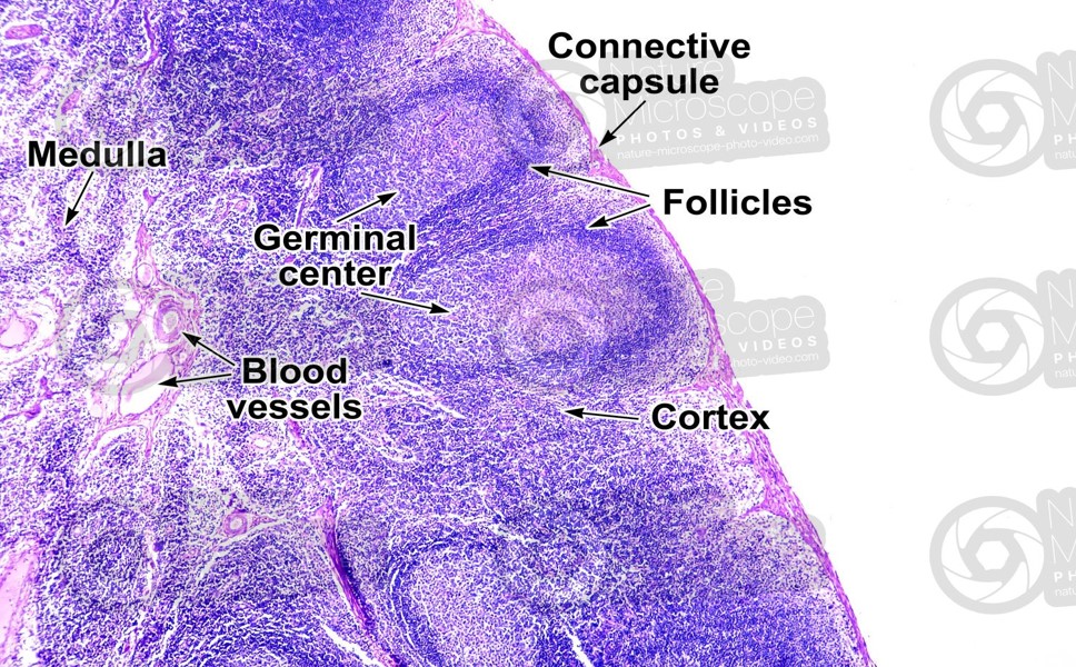 LYMPHNODE-HISTOLOGY 1.jpg