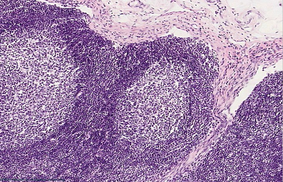LYMPHNODE-HISTOLOGY.jpg
