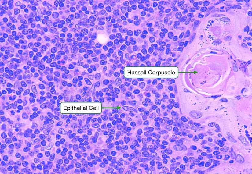 MEDULLA OF THYMUS.jpg