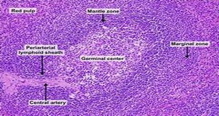 SPLENIC NODULES-PALS 1.jpg