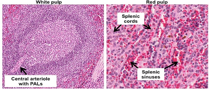SPLENIC NODULES-PALS.jpg