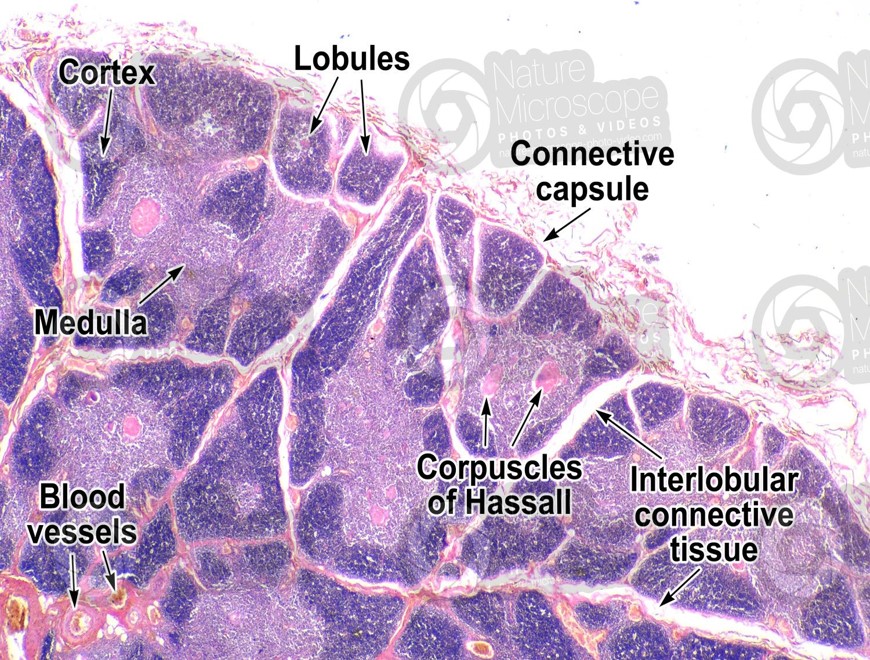 THYMUS –H & E 1.jpg