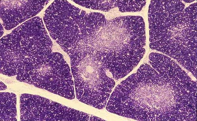 THYMUS –H & E.jpg