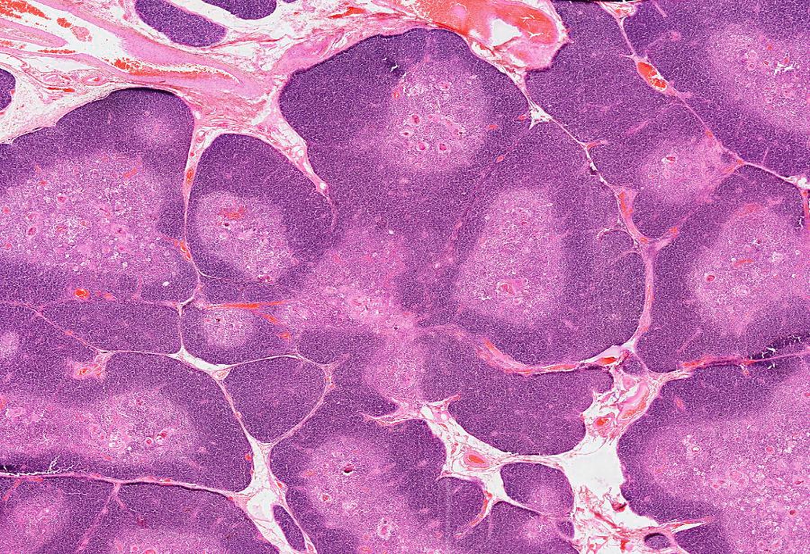 THYMUS- HISTOLOGY.jpg
