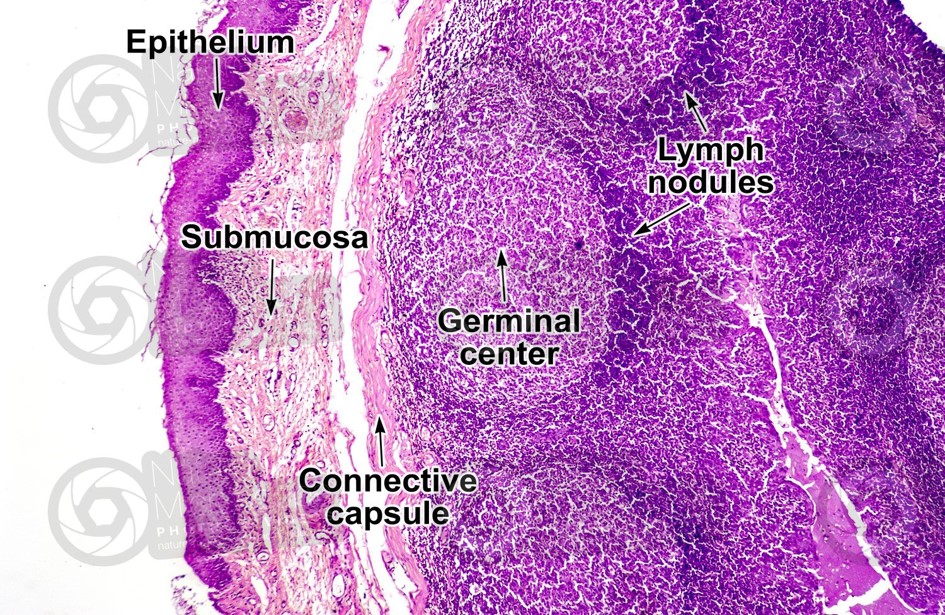 TONSIL- HISTOLOGY.jpg