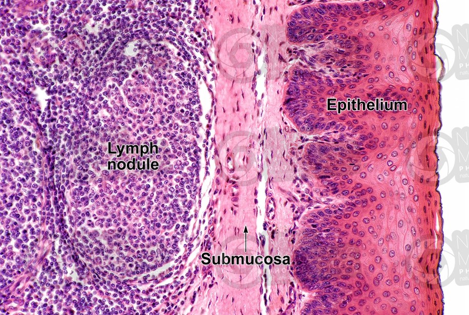 TONSIL- HISTOLOGY-HIGH POWER.jpg