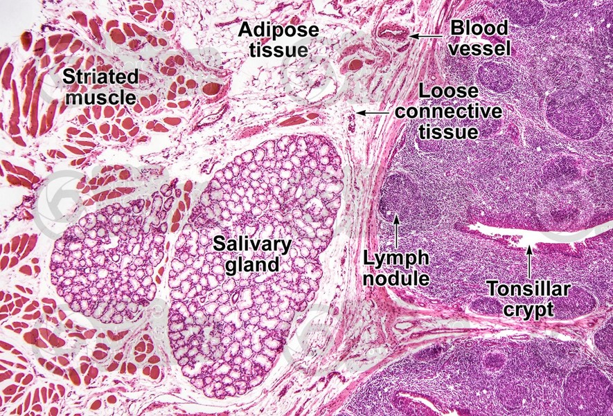 TONSIL-HISTOLOGY.jpg