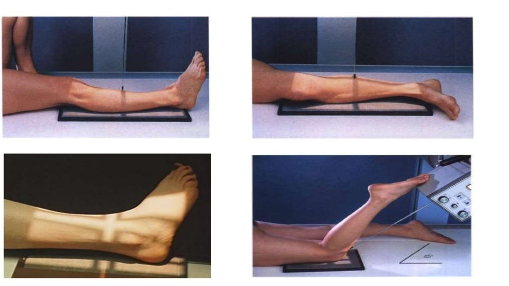 LOWER LIMB.jpg
