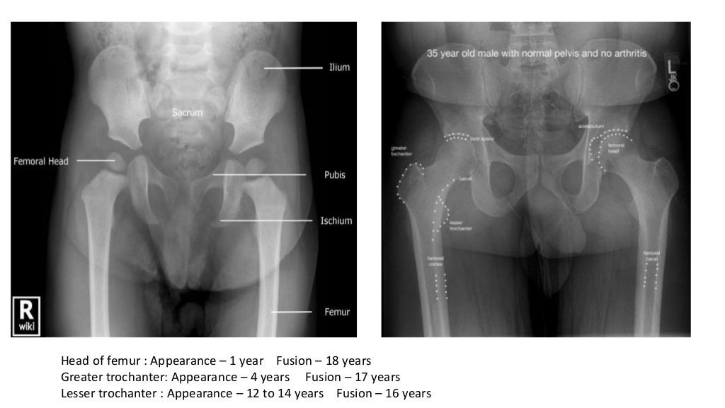 AGE DETERMINATION 2.jpg