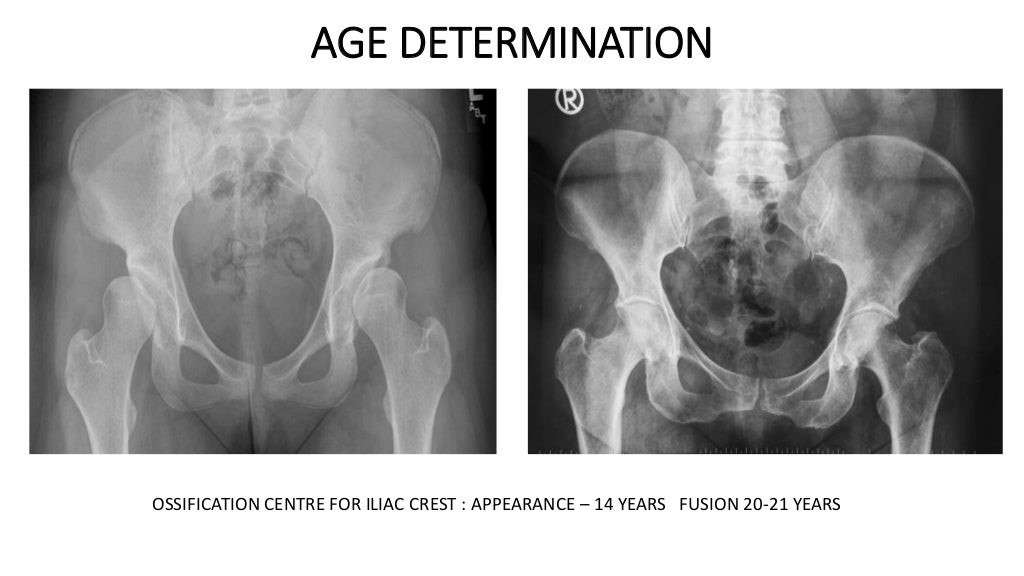 AGE DETERMINATION.jpg