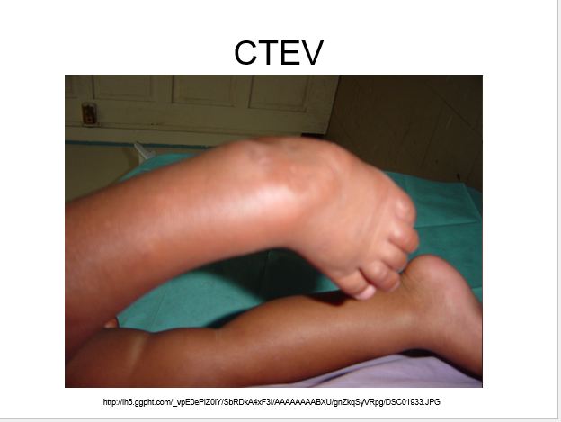 CTEV.png