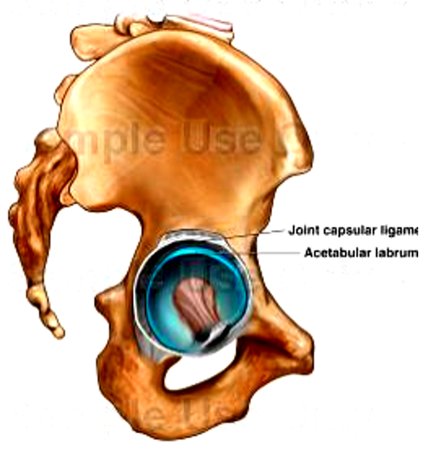 acetabular labrum.png