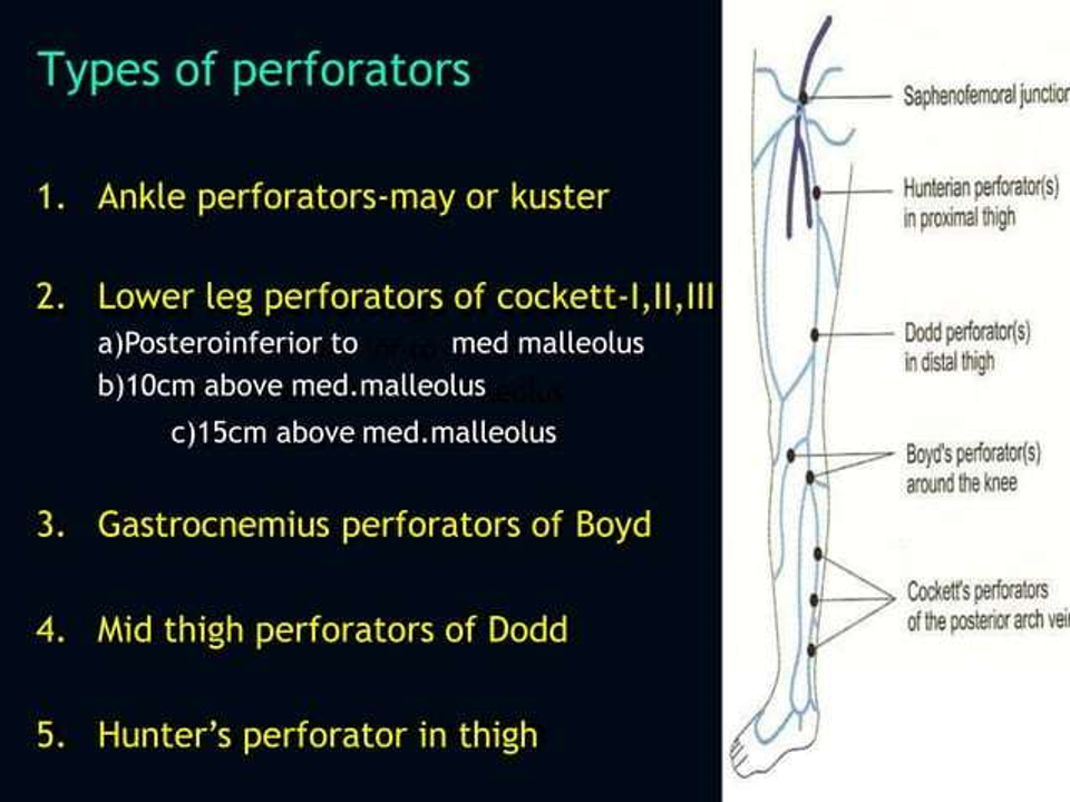types of perforators.png