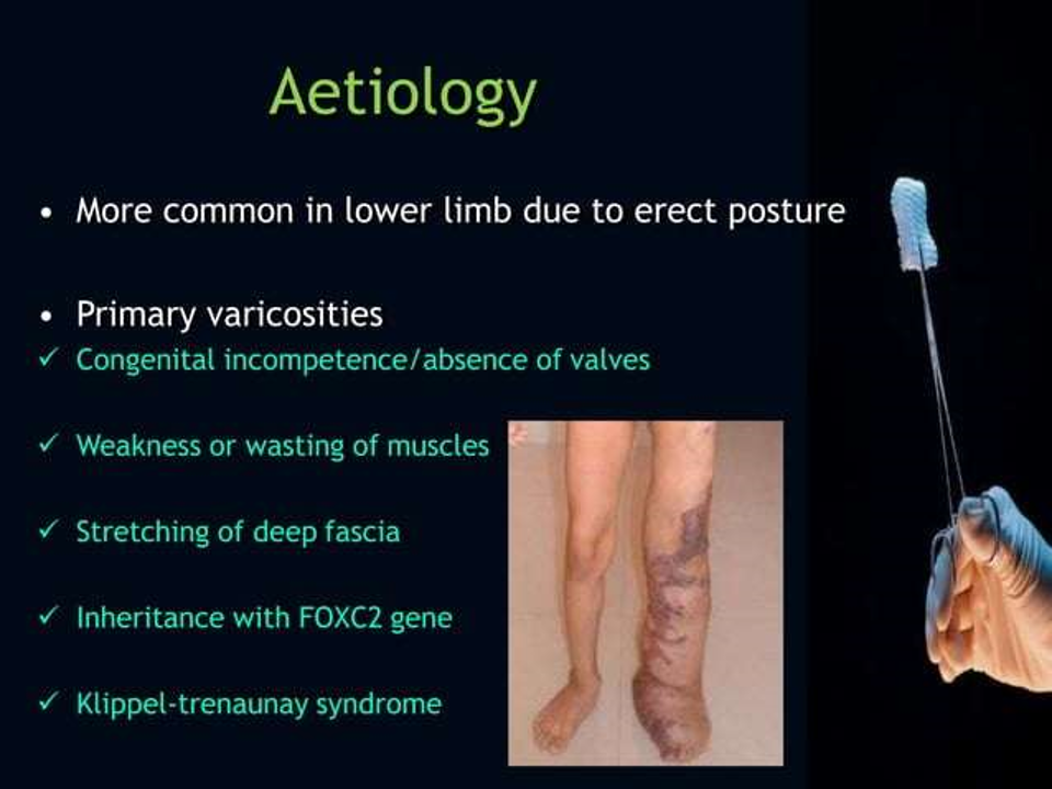 aetiology.png