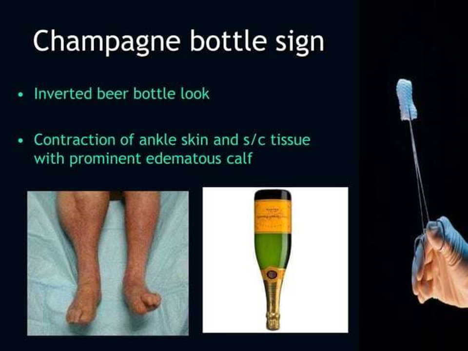 champange bottle sign.png