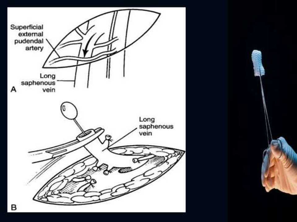 figure 10.png