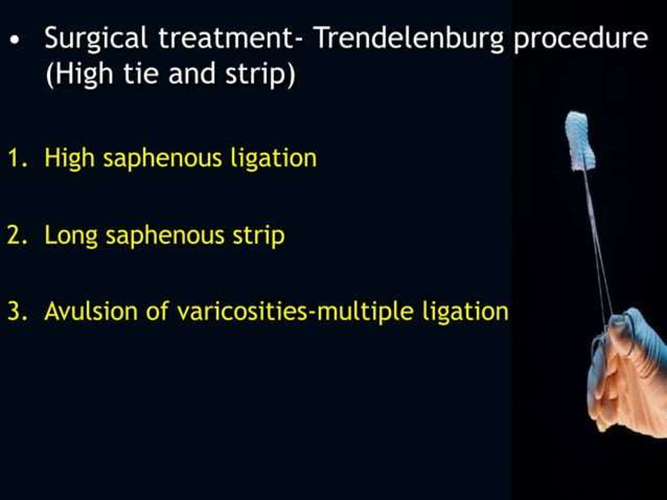 surgical treatment.png
