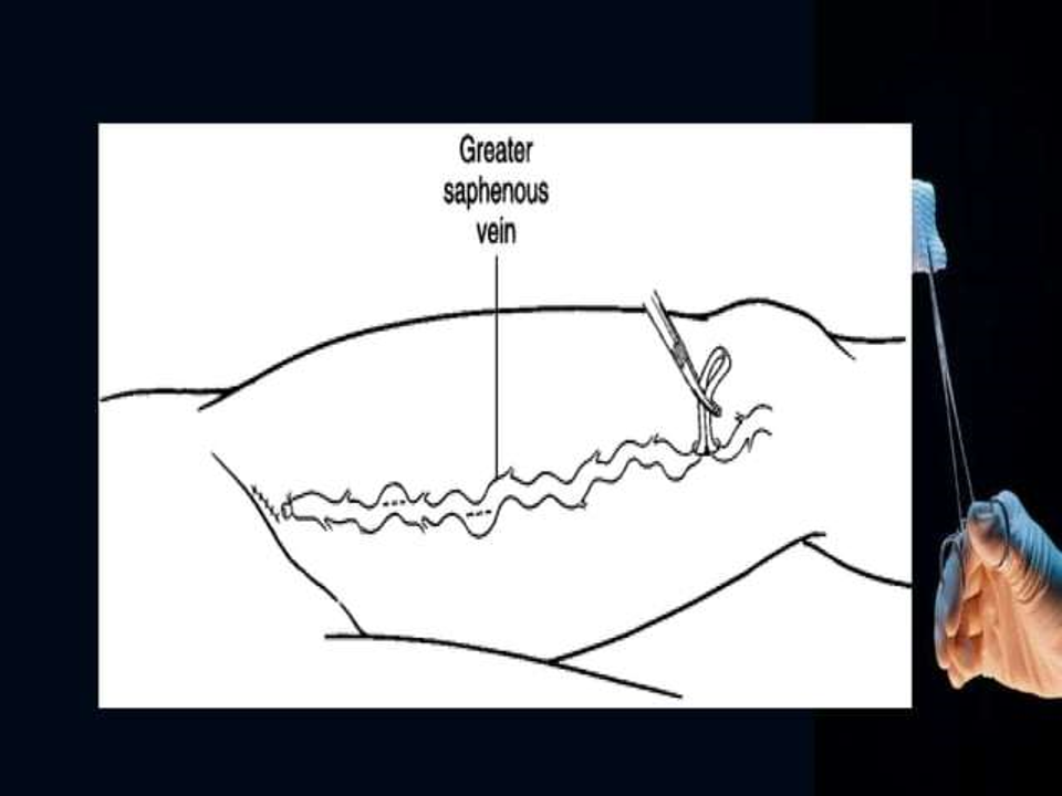 figure 14.png