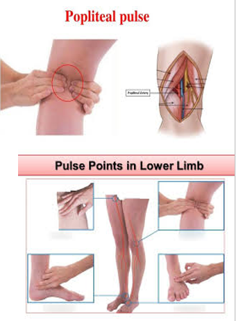 LOWER LIMB (R & Q) Picture 4.png