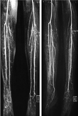 LOWER LIMB (R & Q) Picture 5.png