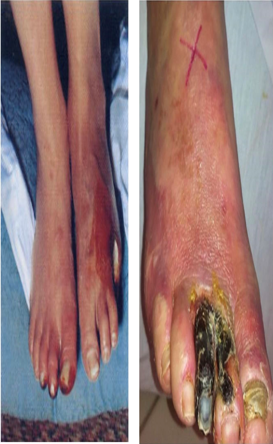 LOWER LIMB (R & Q) Picture 5.1.png