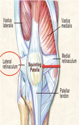 LOWER LIMB (R & Q) Picture 6.png