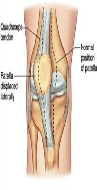 LOWER LIMB (R & Q) Picture 6.1.png