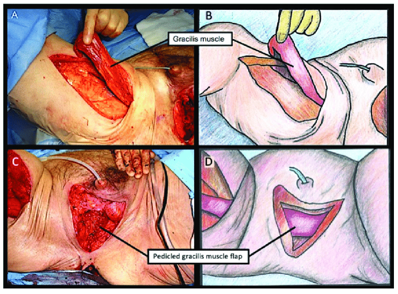 LOWER LIMB (R & Q) Picture 10.2.png